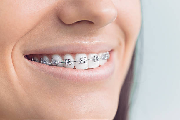 Best Traditional Braces  in Pine Brook, NJ